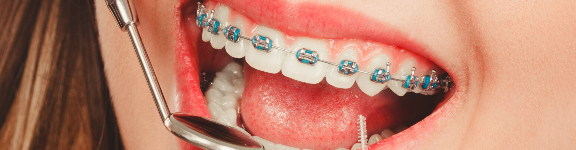 Dental tools being used in mouth with braces on teeth.